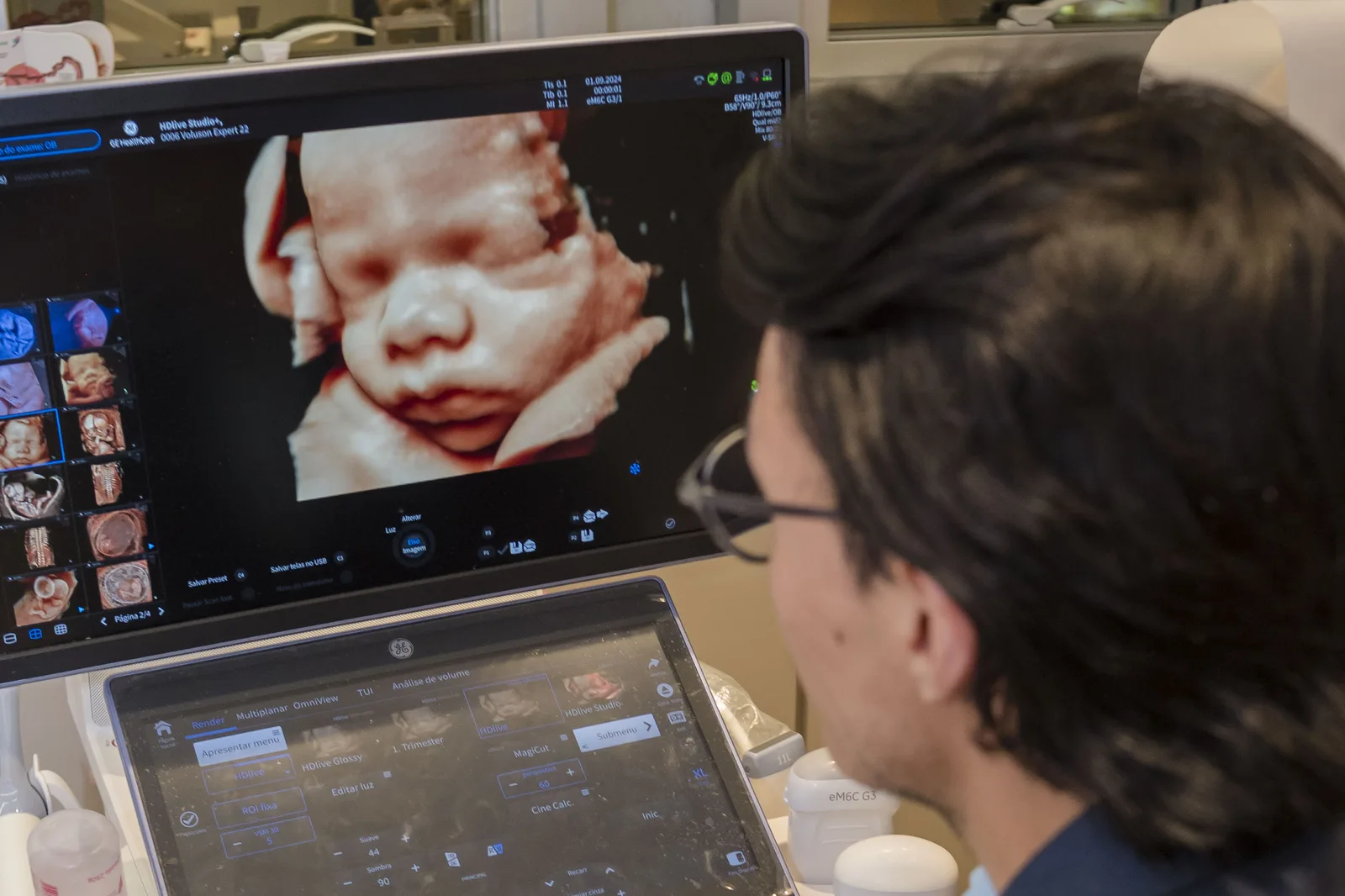 Dr. Héctor operando o aparelho de ultrassom durante um exame, com a imagem do bebê na tela