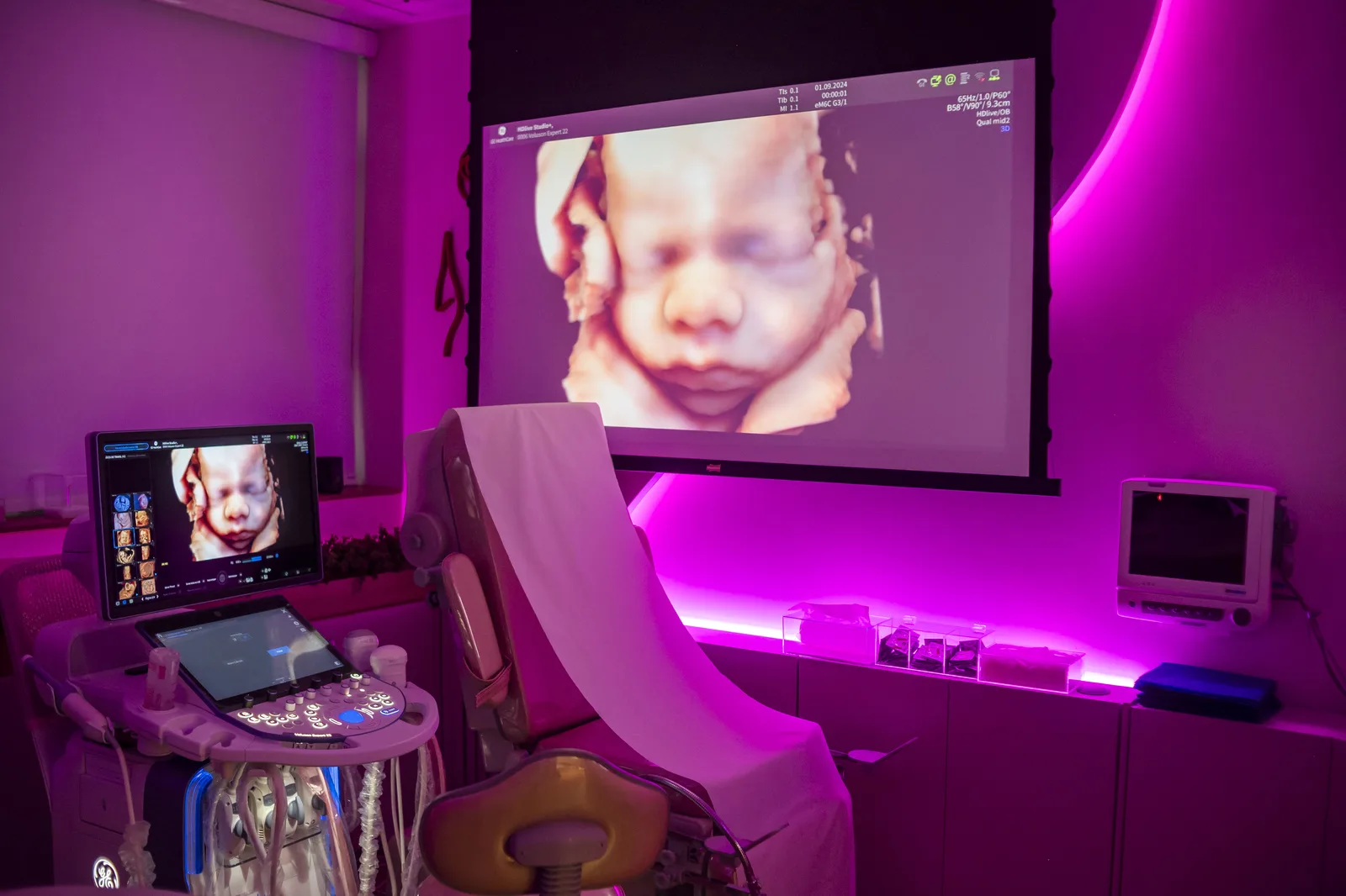 Sala de exame com a imagem do bebê projetada em tela grande e o aparelho de ultrassom ao lado da maca