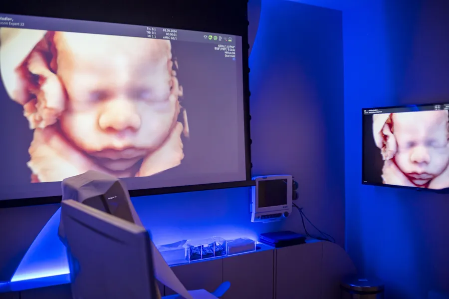 Sala de exame com iluminação azul e a imagem do bebê em tela grande