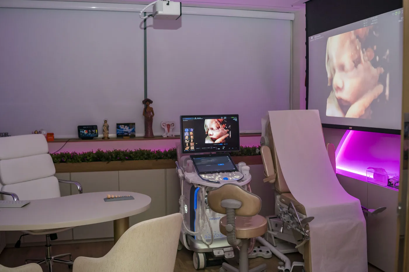 Sala de ultrassonografia com a imagem do bebê projetada em tela grande e iluminação ambiente