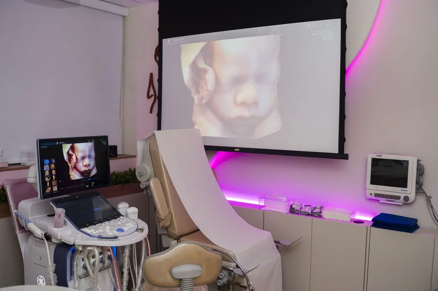 Tela de projeção com a imagem do bebê ao lado do aparelho de ultrassom